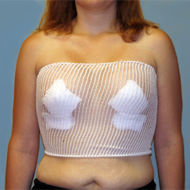 What Type of Bra is Best After Breast Augmentation? |  MyBreastAugmentation.info