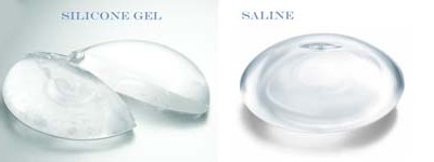 Saline and Silicone Gel Breast Implant Comparison
